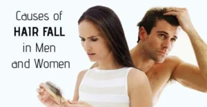 causes of hair fall in men and women