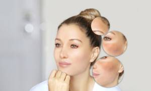 Skin Barrier: What It Is & How to Protect It