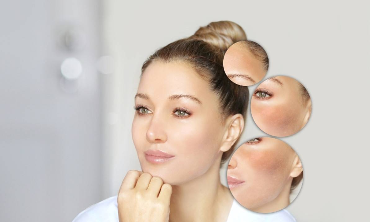 Skin Barrier: What It Is & How to Protect It